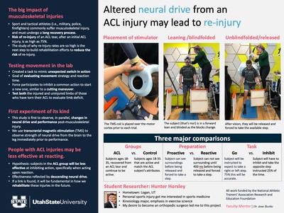 A research poster explains Hunter Horsley's research on changes in neural drive after an ACL injury.